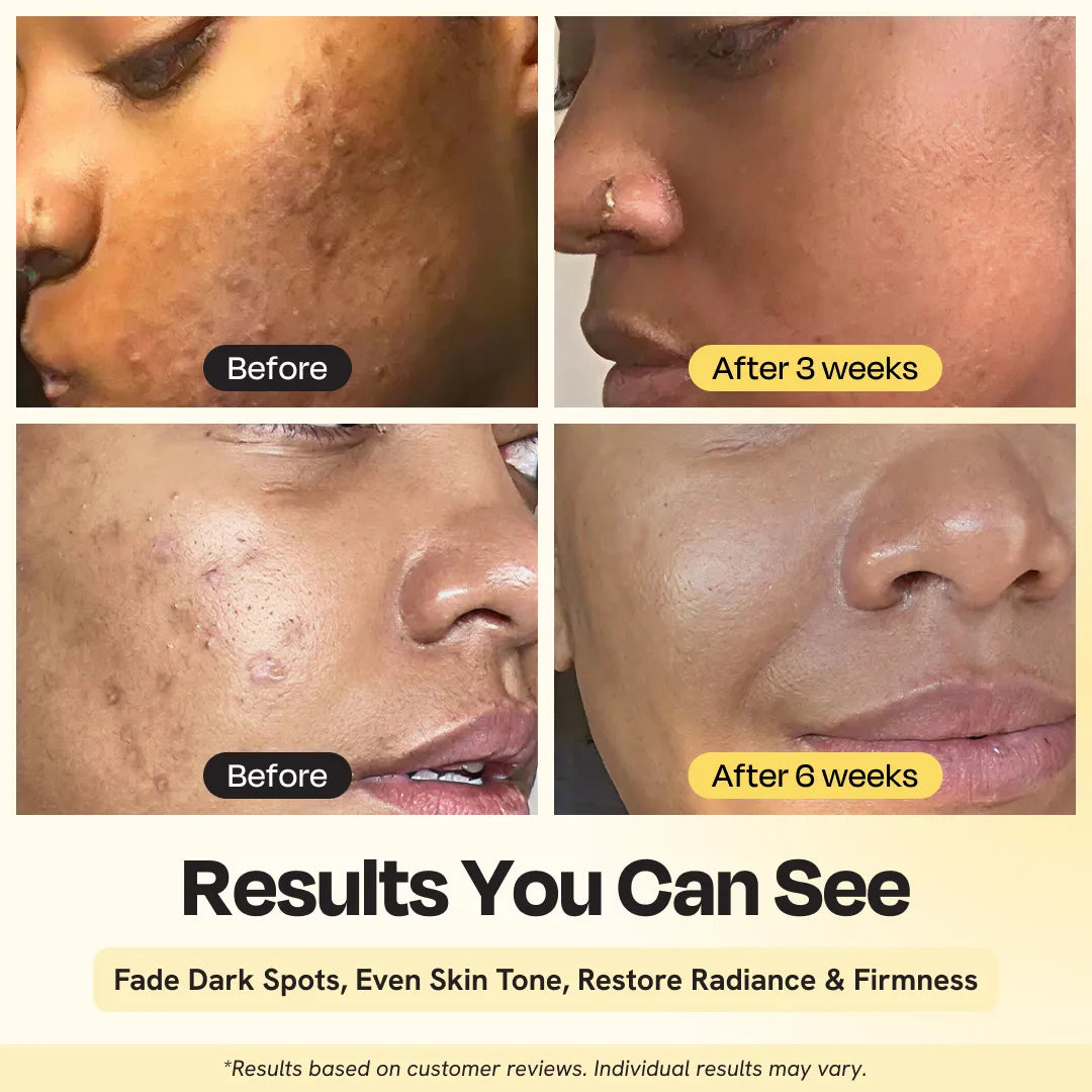 Gleamin Dark Spot Heroes